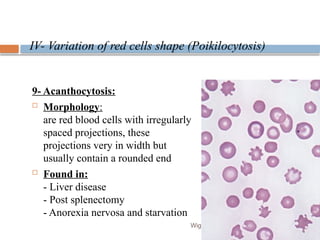 Variation In Rbc Shape RBCs-Abnormal-morphology-final. Cytomophologypptx | PPTX