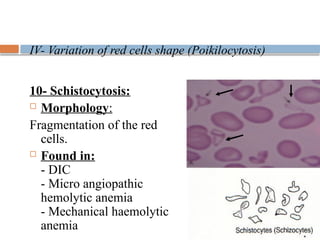 RBCs-Abnormal-morphology-final. Cytomophologypptx | PPT