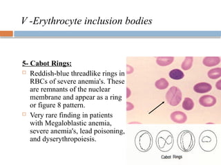 Radioactive Rbcs RBCs-Abnormal-morphology-final. Cytomophologypptx | PPTX