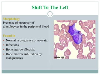 RBC & WBC abnormalities and their interpretation | PPTX