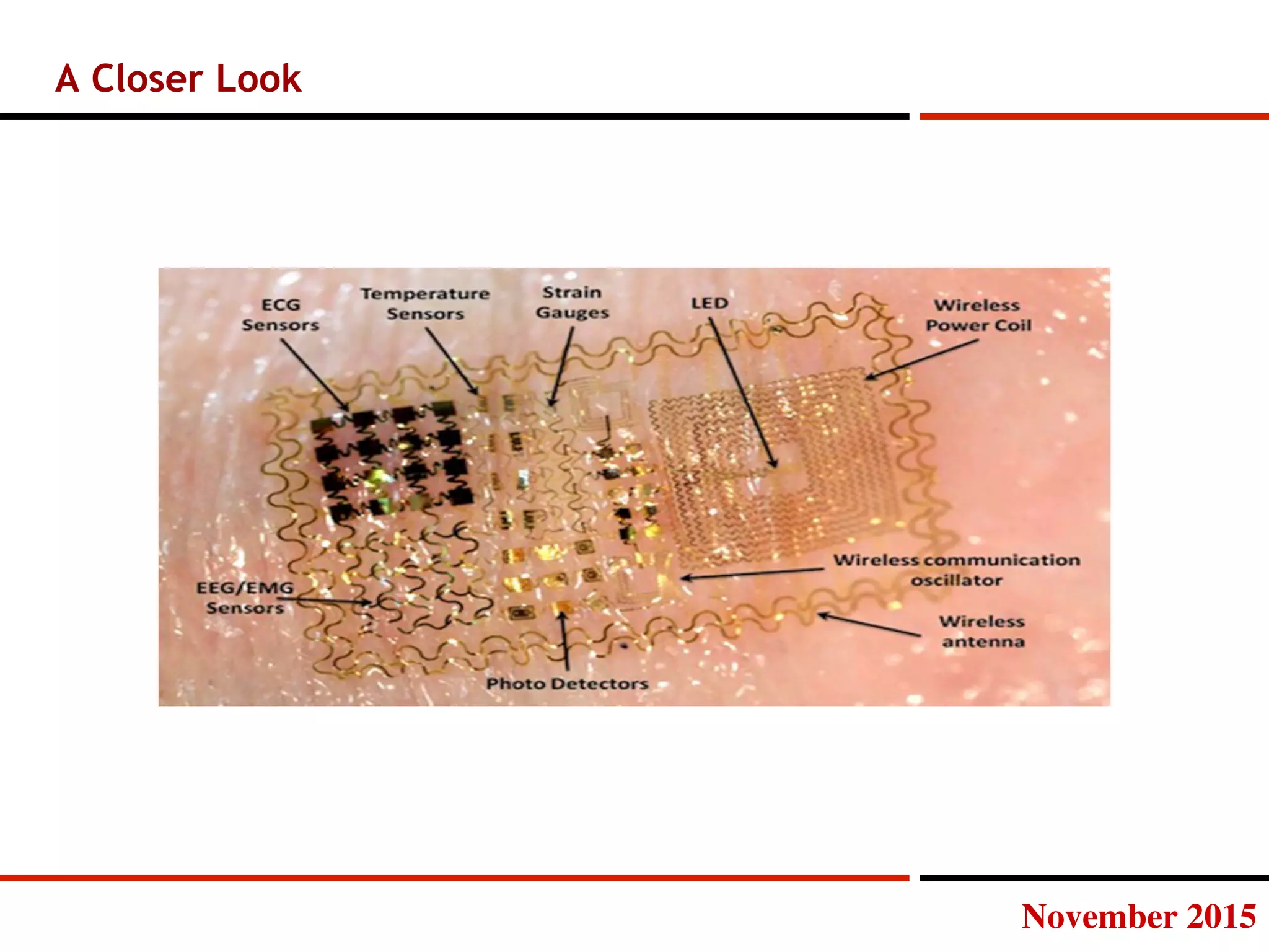 November 2015
A Closer Look
 