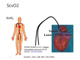Scvo2 Swan Relative Blood Volume Monitoring and Applications in Dialysis | PPTX
