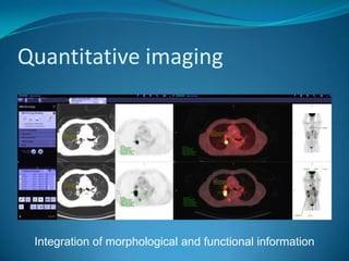  all modern imaging modalitiesEndoscopic Surgery SuiteControl via touch screenImage with courtesy of Olympus