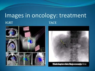 Endoscopic Surgery SuiteHospital networkCommunication via hospital networkCentral storageConsulting patient file from PACS IIOlympus Endoalpha Control Unit