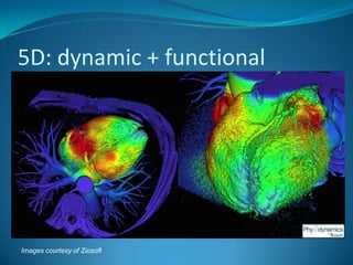 Quantitative imagingused to evaluate responses to cancer treatment or assess tumour burden