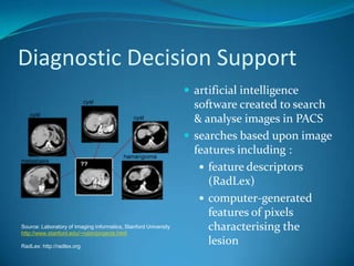 Seamless integration and interconnectivityThe biggest gains will come from the seamless connectionof RIS/PACS and EPR with imagesIntegration of other applications should appear seamless to the radiologistThe longer term solution is to make transmural image transfer by DVDs and CDs unnecessary. This requires an interconnected, broadly based EPR system (“virtual cloud”)