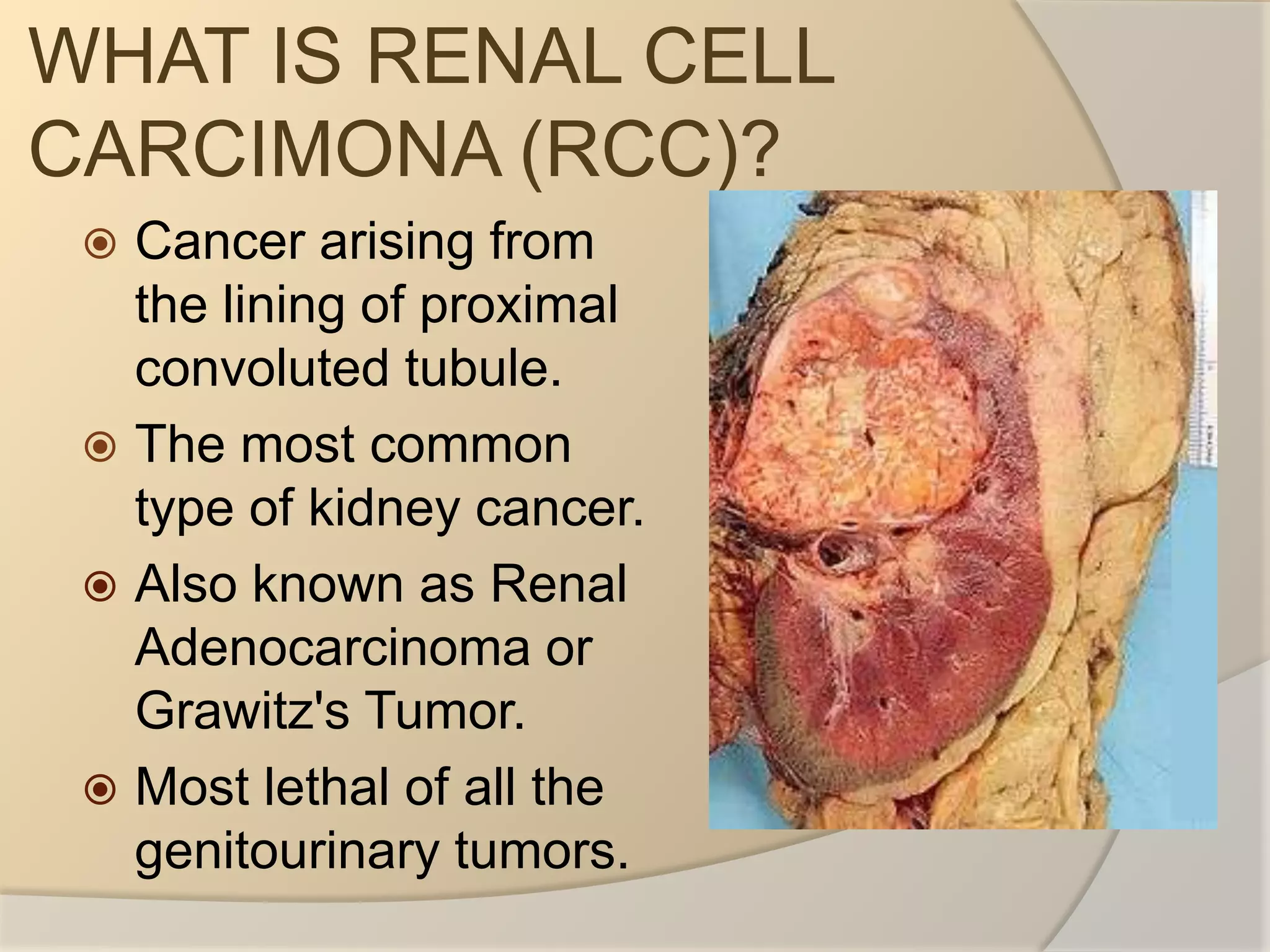 Renal Cell Carcinoma Gross Anatomy