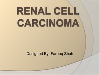 RENAL CELL CARCINOMA  Designed By: Farooq Shah 