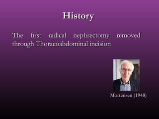 HistoryHistory
The first radical nephrectomy removedThe first radical nephrectomy removed
through Thoracoabdominal incisionthrough Thoracoabdominal incision
Mortensen (1948)
 