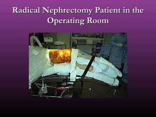 Radical Nephrectomy Patient in theRadical Nephrectomy Patient in the
Operating RoomOperating Room
 