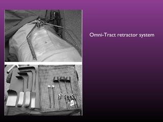 Omni-Tract retractor system
 