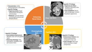 Renal cell carcinoma: clinical feature | PPTX