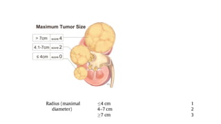 Small Rcc Usg imaging in RCC | PPTX