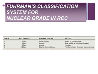 + FUHRMAN’S CLASSIFICATION
SYSTEM FOR
NUCLEAR GRADE IN RCC
 