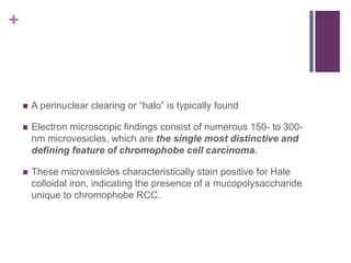 +
 A perinuclear clearing or “halo” is typically found
 Electron microscopic findings consist of numerous 150- to 300-
nm microvesicles, which are the single most distinctive and
defining feature of chromophobe cell carcinoma.
 These microvesicles characteristically stain positive for Hale
colloidal iron, indicating the presence of a mucopolysaccharide
unique to chromophobe RCC.
 