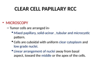 Acinar Pattern Rcc Adult epithelial renal tumors and update of WHO classification of renal ...