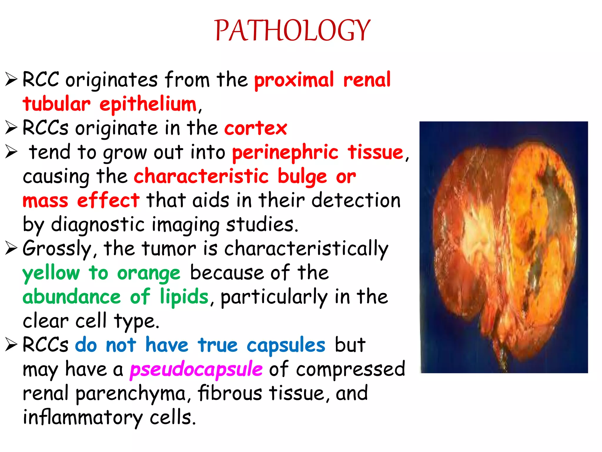 Rcc and bladder cancer | PPT