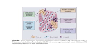 Management of Renal Cell Carcinoma ppt.pptx