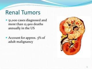 RENAL CELL CARCINOMA | PPTX