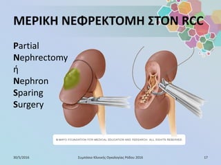 ΜΕΡΙΚΗ ΝΕΦΡΕΚΤΟΜΗ ΣΤΟΝ RCC
Partial
Nephrectomy
ή
Nephron
Sparing
Surgery
30/5/2016 17Συμπόσιο Κλινικής Ογκολογίας Ρόδου 2016
 
