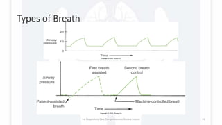 Types of Breath
1st Respiratory Care Comprehensive Review Course 41
 