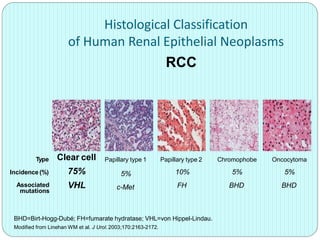 BHD=Birt-Hogg-Dubé; FH=fumarate hydratase; VHL=von Hippel-Lindau.
Modified from Linehan WM et al. J Urol. 2003;170:2163-2172.
Histological Classification
of Human Renal Epithelial Neoplasms
RCC
Type
Incidence (%)
Associated
mutations
Clear cell
75%
VHL
Papillary type 1
5%
c-Met
Papillary type 2
10%
FH
Chromophobe
5%
BHD
Oncocytoma
5%
BHD
 