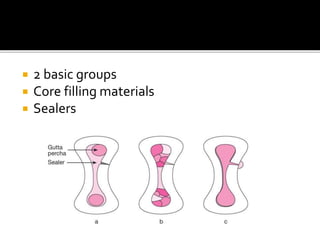  2 basic groups
 Core filling materials
 Sealers
 