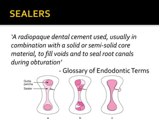 ‘A radiopaque dental cement used, usually in
combination with a solid or semi-solid core
material, to fill voids and to seal root canals
during obturation’
- Glossary of EndodonticTerms
 