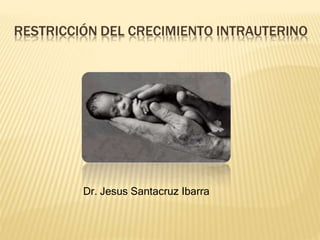 RESTRICCIÓN DEL CRECIMIENTO INTRAUTERINO
Dr. Jesus Santacruz Ibarra
 
