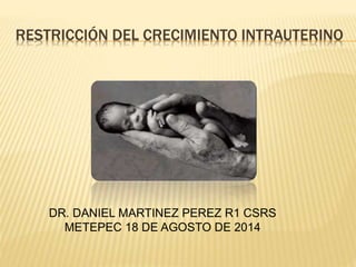 RESTRICCIÓN DEL CRECIMIENTO INTRAUTERINO 
DR. DANIEL MARTINEZ PEREZ R1 CSRS 
METEPEC 18 DE AGOSTO DE 2014 
 
