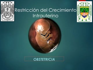 Restricción del Crecimiento
Intrauterino
OBSTETRICIA
 