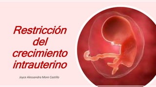 Restricción
del
crecimiento
intrauterino
Joyce Alessandra More Castillo
 