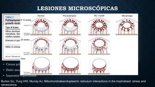 LESIONES MICROSCÓPICAS
Burton GJ, Yung HW, Murray AJ. Mitochondrialeendoplasmic reticulum interactions in the trophoblast:...