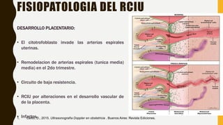 RCIU 2021 corta ginecologia obstetricia medicina | PPTX