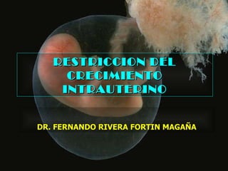 RESTRICCION DEL CRECIMIENTO INTRAUTERINO DR. FERNANDO RIVERA FORTIN MAGAÑA 