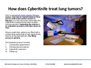 How	
  does	
  CyberKnife	
  treat	
  lung	
  tumors?	
  
Prior	
  to	
  stereotac?c	
  body	
  radia?on	
  therapy,	
  
d...