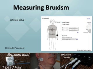 Measuring Bruxism
     Software Setup




Electrode Placement




1/21/12               Randy Clare and Associates   28
 