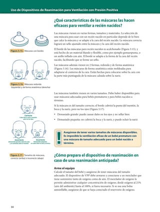 Uso de Dispositivos de Reanimación para Ventilación con Presión Positiva
88
¿Qué características de las máscaras las hacen
eficaces para ventilar a recién nacidos?
Las máscaras vienen en varias formas, tamaños y materiales. La selección de
una máscara para usar con un recién nacido en particular depende de lo bien
que calce la máscara y se adapte a la cara del recién nacido. La máscara correcta
logrará un sello ajustado entre la máscara y la cara del recién nacido.
El borde de las máscaras para recién nacidos es acolchonado (Figura 3.15), y
está hecho de un material blando y flexible, como por ejemplo gomaespuma, o
un anillo inflado con aire. El borde se adapta a la forma de la cara del recién
nacido, facilitando que se forme un sello.
Las máscaras además vienen en 2 formas, redonda y de forma anatómica
(Figura 3.16). Las máscaras de forma anatómica están moldeadas para
adaptarse al contorno de la cara. Están hechas para colocarse sobre la cara con
la parte más puntiaguda de la máscara calzada sobre la nariz.
Las máscaras también vienen en varios tamaños. Debe haber disponibles para
usar máscaras adecuadas para bebés prematuros y para bebés nacidos a
término.
Si la máscara es del tamaño correcto, el borde cubrirá la punta del mentón, la
boca y la nariz, pero no los ojos (Figura 3.17).
• Demasiado grande: puede causar daño en los ojos y no sellar bien
• Demasiado pequeña: no cubrirá la boca y la nariz, y puede ocluir la nariz
¿Cómo prepara el dispositivo de reanimación en
caso de una reanimación anticipada?
Arme el equipo
Calcule el tamaño del bebé y asegúrese de tener máscaras del tamaño
adecuado. El dispositivo de VPP debe armarse y conectarse a un mezclador que
tiene suministro tanto de oxígeno como de aire. El mezclador de oxígeno le
permite administrar cualquier concentración de oxígeno, desde oxígeno al 21%
(aire del ambiente) hasta al 100%, si fuera necesario. Si se usa una bolsa
autoinflable, asegúrese de que se haya conectado el reservorio de oxígeno.
Figura 3.15. Máscaras con bordes
Figura 3.16. Máscaras redonda
(izquierda) y de forma anatómica (derecha)
Correcto
Cubre boca,nariz y mentón
pero no los ojos
Incorrecto
Demasiado grande: cubre los ojos
y se extiende sobre el mentón
Incorrecto
Demasiado pequeña:
no cubre bien la nariz y la boca
Figura 3.17. Tamaños de máscaras,
correcto (arriba) e incorrecto (abajo)
Asegúrese de tener varios tamaños de máscaras disponibles.
Es imposible la ventilación eficaz de un bebé prematuro con
una máscara de tamaño adecuado para un bebé nacido a
término.
 