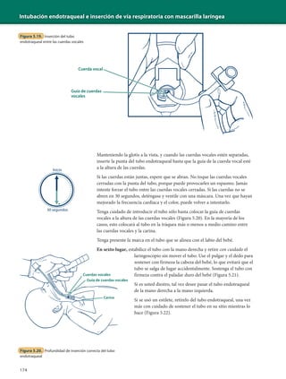 Intubación endotraqueal e inserción de vía respiratoria con mascarilla laríngea
174
Manteniendo la glotis a la vista, y cuando las cuerdas vocales estén separadas,
inserte la punta del tubo endotraqueal hasta que la guía de la cuerda vocal esté
a la altura de las cuerdas.
Si las cuerdas están juntas, espere que se abran. No toque las cuerdas vocales
cerradas con la punta del tubo, porque puede provocarles un espasmo. Jamás
intente forzar el tubo entre las cuerdas vocales cerradas. Si las cuerdas no se
abren en 30 segundos, deténgase y ventile con una máscara. Una vez que hayan
mejorado la frecuencia cardíaca y el color, puede volver a intentarlo.
Tenga cuidado de introducir el tubo sólo hasta colocar la guía de cuerdas
vocales a la altura de las cuerdas vocales (Figura 5.20). En la mayoría de los
casos, esto colocará al tubo en la tráquea más o menos a medio camino entre
las cuerdas vocales y la carina.
Tenga presente la marca en el tubo que se alinea con el labio del bebé.
En sexto lugar, estabilice el tubo con la mano derecha y retire con cuidado el
laringoscopio sin mover el tubo. Use el pulgar y el dedo para
sostener con firmeza la cabeza del bebé, lo que evitará que el
tubo se salga de lugar accidentalmente. Sostenga el tubo con
firmeza contra el paladar duro del bebé (Figura 5.21).
Si es usted diestro, tal vez desee pasar el tubo endotraqueal
de la mano derecha a la mano izquierda.
Si se usó un estilete, retírelo del tubo endotraqueal, una vez
más con cuidado de sostener el tubo en su sitio mientras lo
hace (Figura 5.22).
Cuerdas vocales
Guía de cuerdas vocales
Figura 5.20. Profundidad de inserción correcta del tubo
endotraqueal
Inicio
30 segundos
Cuerda vocal
Guía de cuerdas
vocales
Figura 5.19. Inserción del tubo
endotraqueal entre las cuerdas vocales
 