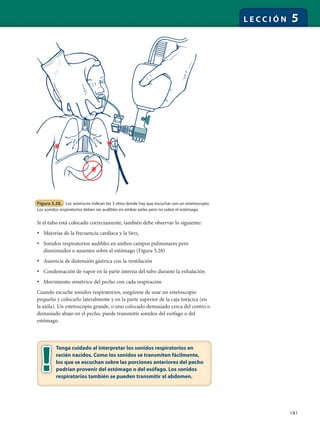 181
L E C C I Ó N 5
Si el tubo está colocado correctamente, también debe observar lo siguiente:
• Mejorías de la frecuencia cardíaca y la Spo2
• Sonidos respiratorios audibles en ambos campos pulmonares pero
disminuidos o ausentes sobre el estómago (Figura 5.28)
• Ausencia de distensión gástrica con la ventilación
• Condensación de vapor en la parte interna del tubo durante la exhalación
• Movimiento simétrico del pecho con cada respiración
Cuando escuche sonidos respiratorios, asegúrese de usar un estetoscopio
pequeño y colocarlo lateralmente y en la parte superior de la caja torácica (en
la axila). Un estetoscopio grande, o uno colocado demasiado cerca del centro o
demasiado abajo en el pecho, puede transmitir sonidos del esófago o del
estómago.
*
*
*
Figura 5.28. Los asteriscos indican los 3 sitios donde hay que escuchar con un estetoscopio.
Los sonidos respiratorios deben ser audibles en ambas axilas pero no sobre el estómago.
Tenga cuidado al interpretar los sonidos respiratorios en
recién nacidos. Como los sonidos se transmiten fácilmente,
los que se escuchan sobre las porciones anteriores del pecho
podrían provenir del estómago o del esófago. Los sonidos
respiratorios también se pueden transmitir al abdomen.
 