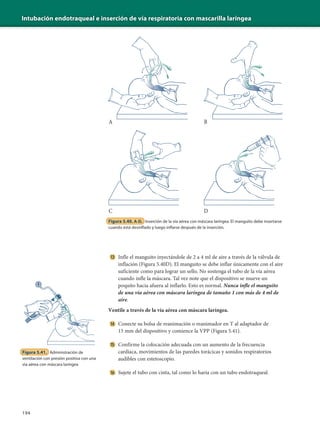 Intubación endotraqueal e inserción de vía respiratoria con mascarilla laríngea
194
Infle el manguito inyectándole de 2 a 4 ml de aire a través de la válvula de
inflación (Figura 5.40D). El manguito se debe inflar únicamente con el aire
suficiente como para lograr un sello. No sostenga el tubo de la vía aérea
cuando infle la máscara. Tal vez note que el dispositivo se mueve un
poquito hacia afuera al inflarlo. Esto es normal. Nunca infle el manguito
de una vía aérea con máscara laríngea de tamaño 1 con más de 4 ml de
aire.
Ventile a través de la vía aérea con máscara laríngea.
Conecte su bolsa de reanimación o reanimador en T al adaptador de
15 mm del dispositivo y comience la VPP (Figura 5.41).
Confirme la colocación adecuada con un aumento de la frecuencia
cardíaca, movimientos de las paredes torácicas y sonidos respiratorios
audibles con estetoscopio.
Sujete el tubo con cinta, tal como lo haría con un tubo endotraqueal.
Figura 5.41. Administración de
ventilación con presión positiva con una
vía aérea con máscara laríngea
Figura 5.40. A-D. Inserción de la vía aérea con máscara laríngea. El manguito debe insertarse
cuando está desinflado y luego inflarse después de la inserción.
A B
C
1
2
3
4
5
6
D
 