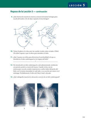 199
L E C C I Ó N 5
Repaso de la Lección 5 — continuación
9. ¿Qué ilustración muestra la manera correcta de levantar la lengua para
sacarla del medio a fin de dejar expuesta el área faríngea?
10. Tienen la glotis a la vista, pero las cuerdas vocales están cerradas. (Debe)
(No debe) esperar a que se abran para introducir el tubo.
11. ¿Qué 2 pautas son útiles para determinar la profundidad a la que se
introducirá el tubo endotraqueal en la tráquea del bebé?
_________________________ y _________________________
12. Ha introducido un tubo endotraqueal y está administrando ventilación
con presión positiva a través del mismo. Cuando revisa con un
estetoscopio, escucha sonidos respiratorios a ambos lados del pecho del
bebé, con la misma intensidad en cada lado, y no escucha aire entrar en el
estómago. Probablemente el tubo esté (bien) (mal) colocado.
13. ¿Qué radiografía muestra la colocación correcta de un tubo endotraqueal?
A B
A B
 