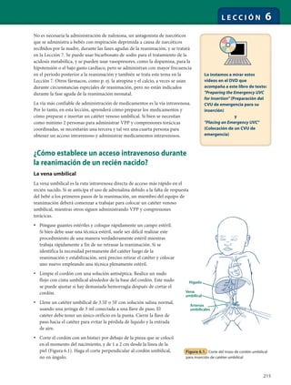 215
L E C C I Ó N 6
No es necesaria la administración de naloxona, un antagonista de narcóticos
que se administra a bebés con respiración deprimida a causa de narcóticos
recibidos por la madre, durante las fases agudas de la reanimación, y se tratará
en la Lección 7. Se puede usar bicarbonato de sodio para el tratamiento de la
acidosis metabólica, y se pueden usar vasopresores, como la dopamina, para la
hipotensión o el bajo gasto cardíaco, pero se administran con mayor frecuencia
en el período posterior a la reanimación y también se trata este tema en la
Lección 7. Otros fármacos, como p. ej. la atropina y el calcio, a veces se usan
durante circunstancias especiales de reanimación, pero no están indicados
durante la fase aguda de la reanimación neonatal.
La vía más confiable de administración de medicamentos es la vía intravenosa.
Por lo tanto, en esta lección, aprenderá cómo preparar los medicamentos y
cómo preparar e insertar un catéter venoso umbilical. Si bien se necesitan
como mínimo 2 personas para administrar VPP y compresiones torácicas
coordinadas, se necesitarán una tercera y tal vez una cuarta persona para
obtener un acceso intravenoso y administrar medicamentos intravenosos.
¿Cómo establece un acceso intravenoso durante
la reanimación de un recién nacido?
La vena umbilical
La vena umbilical es la ruta intravenosa directa de acceso más rápido en el
recién nacido. Si se anticipa el uso de adrenalina debido a la falta de respuesta
del bebé a los primeros pasos de la reanimación, un miembro del equipo de
reanimación deberá comenzar a trabajar para colocar un catéter venoso
umbilical, mientras otros siguen administrando VPP y compresiones
torácicas.
• Póngase guantes estériles y coloque rápidamente un campo estéril.
Si bien debe usar una técnica estéril, suele ser difícil realizar este
procedimiento de una manera verdaderamente estéril mientras
trabaja rápidamente a fin de no retrasar la reanimación. Si se
identifica la necesidad permanente del catéter luego de la
reanimación y estabilización, será preciso retirar el catéter y colocar
uno nuevo empleando una técnica plenamente estéril.
• Limpie el cordón con una solución antiséptica. Realice un nudo
flojo con cinta umbilical alrededor de la base del cordón. Este nudo
se puede ajustar si hay demasiada hemorragia después de cortar el
cordón.
• Llene un catéter umbilical de 3.5F o 5F con solución salina normal,
usando una jeringa de 3 ml conectada a una llave de paso. El
catéter debe tener un único orificio en la punta. Cierre la llave de
paso hacia el catéter para evitar la pérdida de líquido y la entrada
de aire.
• Corte el cordón con un bisturi por debajo de la pinza que se colocó
en el momento del nacimiento, y de 1 a 2 cm desde la línea de la
piel (Figura 6.1). Haga el corte perpendicular al cordón umbilical,
no en ángulo.
Hígado
Vena
umbilical
Arterias
umbilicales
Figura 6.1. Corte del trozo de cordón umbilical
para inserción de catéter umbilical
Lo instamos a mirar estos
videos en el DVD que
acompaña a este libro de texto:
"Preparing the Emergency UVC
for Insertion" (Preparación del
CVU de emergencia para su
inserción)
y
"Placing an Emergency UVC"
(Colocación de un CVU de
emergencia)
 