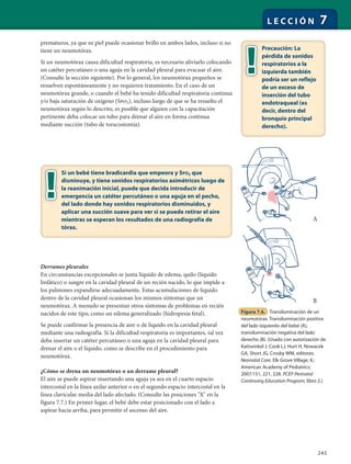243
L E C C I Ó N 7
prematuros, ya que su piel puede ocasionar brillo en ambos lados, incluso si no
tiene un neumotórax.
Si un neumotórax causa dificultad respiratoria, es necesario aliviarlo colocando
un catéter percutáneo o una aguja en la cavidad pleural para evacuar el aire.
(Consulte la sección siguiente). Por lo general, los neumotórax pequeños se
resuelven espontáneamente y no requieren tratamiento. En el caso de un
neumotórax grande, o cuando el bebé ha tenido dificultad respiratoria continua
y/o baja saturación de oxígeno (Spo2), incluso luego de que se ha resuelto el
neumotórax según lo descrito, es posible que alguien con la capacitación
pertinente deba colocar un tubo para drenar el aire en forma continua
mediante succión (tubo de toracostomía).
Si un bebé tiene bradicardia que empeora y SPO2 que
disminuye, y tiene sonidos respiratorios asimétricos luego de
la reanimación inicial, puede que decida introducir de
emergencia un catéter percutáneo o una aguja en el pecho,
del lado donde hay sonidos respiratorios disminuidos, y
aplicar una succión suave para ver si se puede retirar el aire
mientras se esperan los resultados de una radiografía de
tórax.
Precaución: La
pérdida de sonidos
respiratorios a la
izquierda también
podría ser un reflejo
de un exceso de
inserción del tubo
endotraqueal (es
decir, dentro del
bronquio principal
derecho).
Derrames pleurales
En circunstancias excepcionales se junta líquido de edema, quilo (líquido
linfático) o sangre en la cavidad pleural de un recién nacido, lo que impide a
los pulmones expandirse adecuadamente. Estas acumulaciones de líquido
dentro de la cavidad pleural ocasionan los mismos síntomas que un
neumotórax. A menudo se presentan otros síntomas de problemas en recién
nacidos de este tipo, como un edema generalizado (hidropesía fetal).
Se puede confirmar la presencia de aire o de líquido en la cavidad pleural
mediante una radiografía. Si la dificultad respiratoria es importantes, tal vez
deba insertar un catéter percutáneo o una aguja en la cavidad pleural para
drenar el aire o el líquido, como se describe en el procedimiento para
neumotórax.
¿Cómo se drena un neumotórax o un derrame pleural?
El aire se puede aspirar insertando una aguja ya sea en el cuarto espacio
intercostal en la línea axilar anterior o en el segundo espacio intercostal en la
línea clavicular media del lado afectado. (Consulte las posiciones "X" en la
figura 7.7.) En primer lugar, el bebé debe estar posicionado con el lado a
aspirar hacia arriba, para permitir el ascenso del aire.
Figura 7.6. Transiluminación de un
neumotórax. Transiluminación positiva
del lado izquierdo del bebé (A),
transiluminación negativa del lado
derecho (B). (Usado con autorización de
Kattwinkel J, Cook LJ, Hurt H, Nowacek
GA, Short JG, Crosby WM, editores.
Neonatal Care. Elk Grove Village, IL:
American Academy of Pediatrics;
2007:151, 221, 228. PCEP Perinatal
Continuing Education Program; libro 2.)
A
B
 