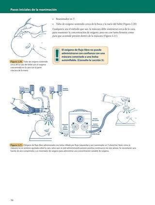 Pasos iniciales de la reanimación
56
• Reanimador en T
• Tubo de oxígeno sostenido cerca de la boca y la nariz del bebé (Figura 2.20)
Cualquiera sea el método que use, la máscara debe sostenerse cerca de la cara,
para mantener la concentración de oxígeno, pero no con tanta firmeza como
para que acumule presión dentro de la máscara (Figura 2.21).
El oxígeno de flujo libre no puede
administrarse con confianza con una
máscara conectada a una bolsa
autoinflable. (Consulte la Lección 3).
Figura 2.20. Tubo de oxígeno sostenido
cerca de la cara del bebé con el oxígeno
concentrado en la cara con la parte
cóncava de la mano
Figura 2.21. Oxígeno de flujo libre administrado con bolsa inflada por flujo (izquierda) y por reanimador en T (derecha). Note cómo la
máscara no se sostiene ajustada sobre la cara, salvo que se esté administrando presión positiva continua en las vías aéreas. Se necesitarán una
fuente de aire comprimido y un mezclador de oxígeno para administrar una concentración variable de oxígeno.
Salida de gasEntrada
de gas
Control
de presión
inspiratoria
Liberación
de la
presión
máxima
Oxígeno
mezclado
Oxígeno
mezclado
Presión
del circuito
 
