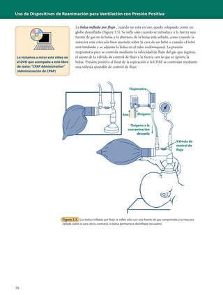 Uso de Dispositivos de Reanimación para Ventilación con Presión Positiva
76
La bolsa inflada por flujo , cuando no está en uso, queda colapsada como un
globo desinflado (Figura 3.3). Se infla sólo cuando se introduce a la fuerza una
fuente de gas en la bolsa y la abertura de la bolsa está sellada, como cuando la
máscara está colocada bien ajustada sobre la cara de un bebé o cuando el bebé
está intubado y se adjunta la bolsa en el tubo endotraqueal. La presión
inspiratoria pico se controla mediante la velocidad de flujo del gas que ingresa,
el ajuste de la válvula de control de flujo y la fuerza con la que se aprieta la
bolsa. Presión positiva al final de la espiración o la CPAP se controlan mediante
una válvula ajustable de control de flujo.
Figura 3.3. Las bolsas infladas por flujo se inflan sólo con una fuente de gas comprimido y la máscara
sellada sobre la cara; de lo contrario, la bolsa permanece desinflada (recuadro)
Válvula de
control de
flujo
Flujómetro
Oxígeno a la
concentración
deseada
Aire Oxígeno
Lo instamos a mirar este video en
el DVD que acompaña a este libro
de texto: "CPAP Administration"
(Administración de CPAP)
 