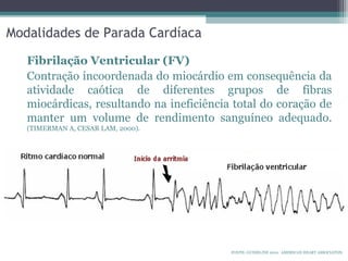 Modalidades de Parada Cardíaca
Fibrilação Ventricular (FV)
Contração incoordenada do miocárdio em consequência da
atividade caótica de diferentes grupos de fibras
miocárdicas, resultando na ineficiência total do coração de
manter um volume de rendimento sanguíneo adequado.
(TIMERMAN A, CESAR LAM, 2000).
FONTE: GUIDELINE 2010. AMERICAN HEART ASSOCIATON.
 