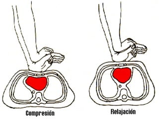 Rcp