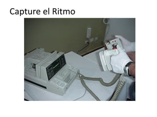 Capture el Ritmo

Prenda desfibrilador y utilice las palas como método muy inmediato de
detección del ritmo.

 