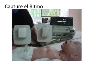 Capture el Ritmo

Utilice paletas pediátricas hasta los 10KG o hasta el año de edad.

 